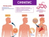 Первоуральцам напомнили о профилактике сифилиса: что важно знать
